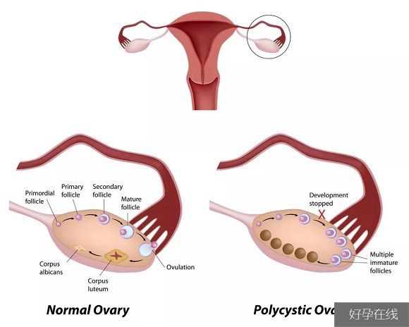 卵巢结构图