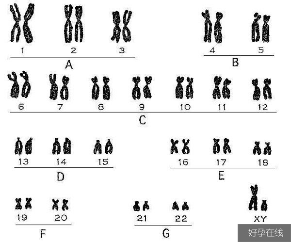 人类染色体核型分析