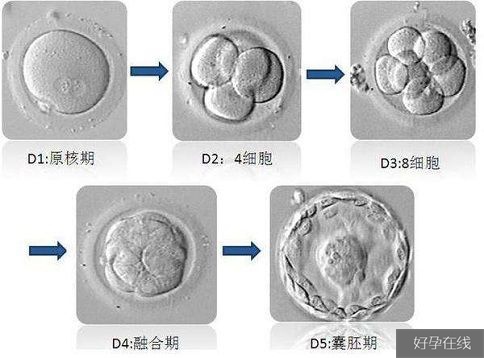 试管婴儿培养