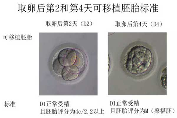 可移植胚胎的标准