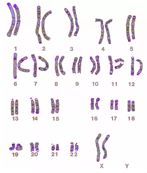 23对染色体