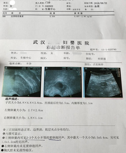 amh检查报告