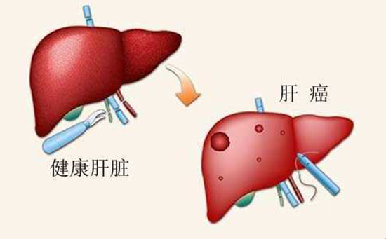 甲胎蛋白可用于肝癌诊断