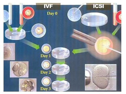 试管婴儿的过程，爸爸的角色也很重要
